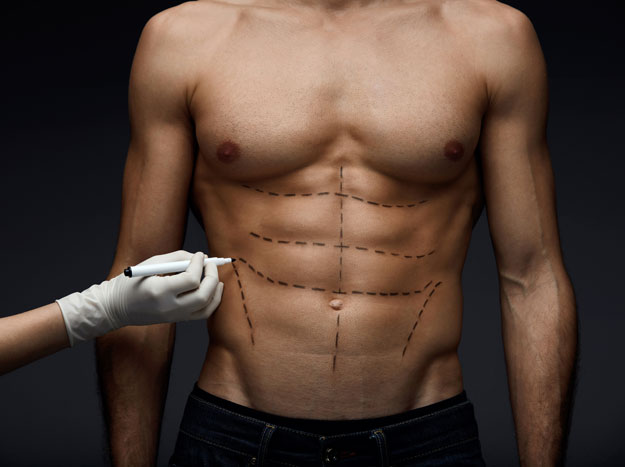 Tummy Tuck (Abdominoplasty) for Men – Rejuveness Scar Healing and Treatment  Products